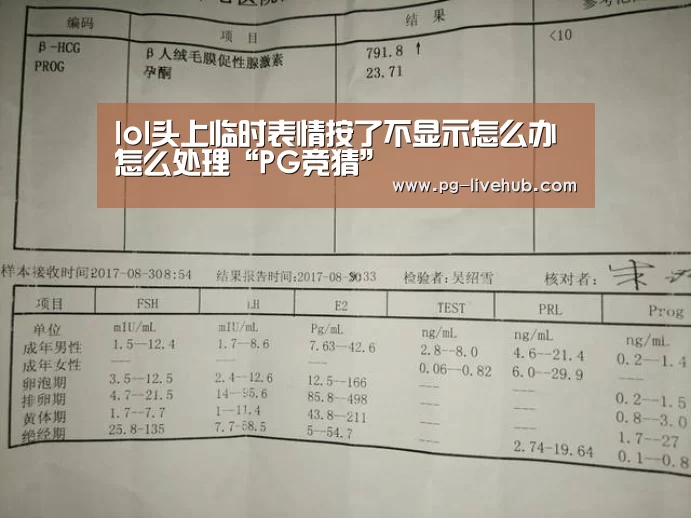 lol头上临时表情按了不显示怎么办怎么处理“PG竞猜”(图2) PG篮球